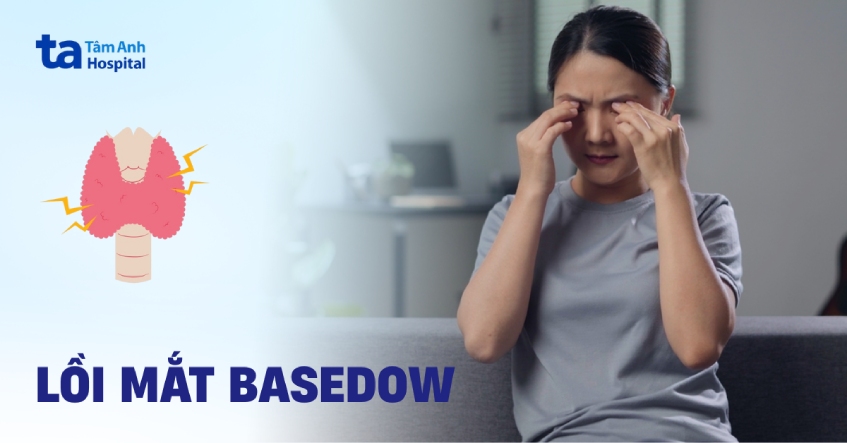 Lồi mắt Basedow có chữa được không? Tại sao lại như vậy?