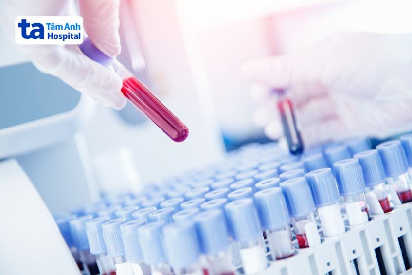 mẫu máu xét nghiệm cho thấy chỉ số hct