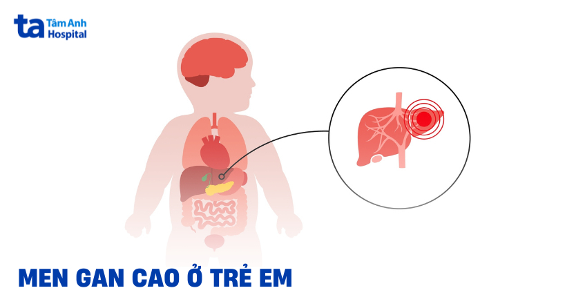 Chứng men gan cao ở trẻ em làm sao để có thể khắc phục?