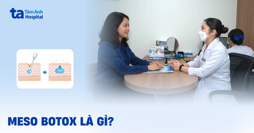 Meso botox và những điểm bạn cần quan tâm