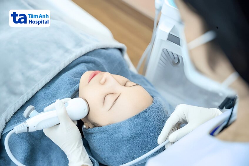 meso không kim là như thế nào