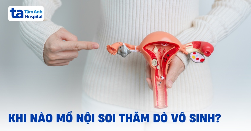 Khi nào cần mổ nội soi thăm dò vô sinh? Quy trình ra sao?