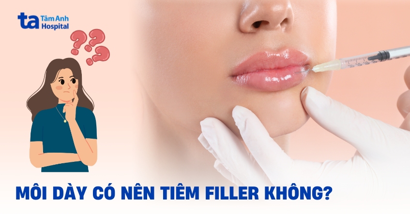 Giải đáp chi tiết: Môi dày có tiêm filler được không?