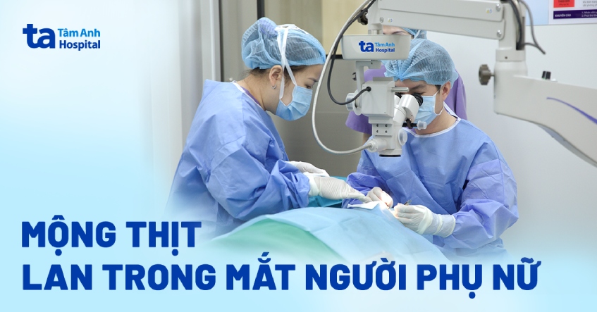Mộng thịt lan trong mắt người phụ nữ