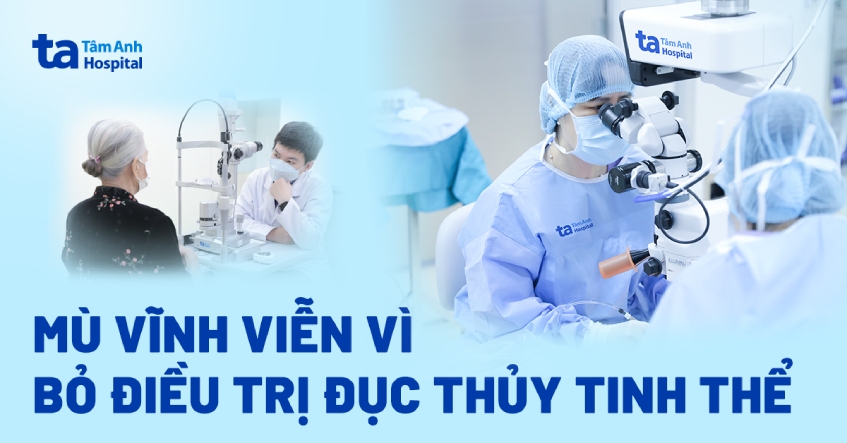 Mù vĩnh viễn vì bỏ điều trị đục thủy tinh thể