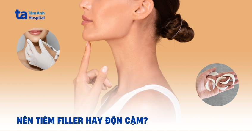 Nên tiêm filler hay độn cằm?