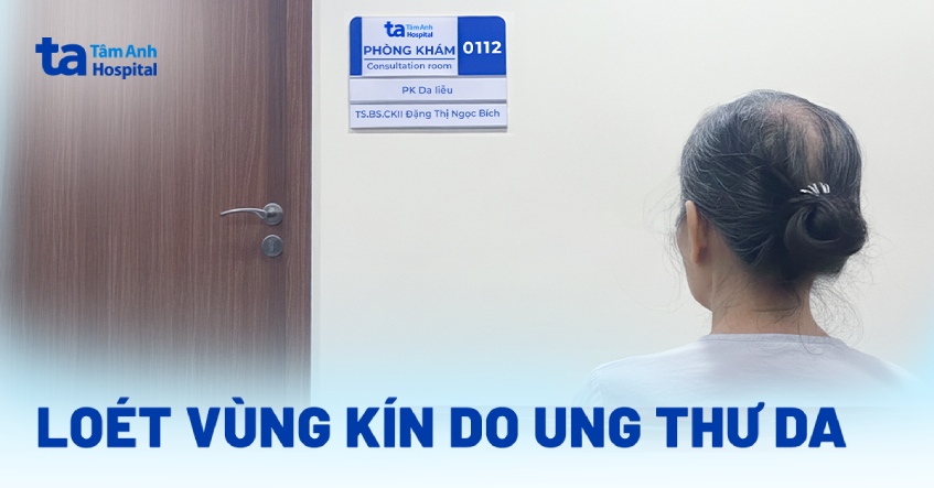 Loét vùng kín do ung thư da