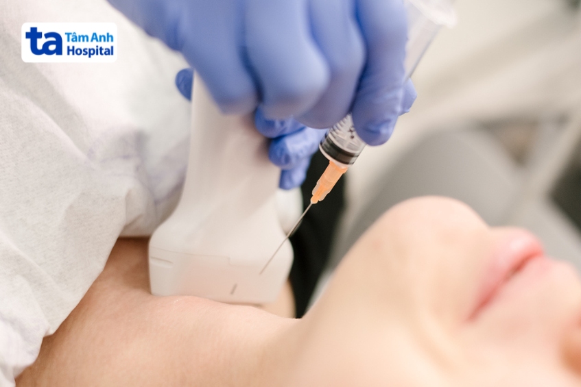 người bệnh có thể được chỉ định chọc hút tế bào bằng kim nhỏ