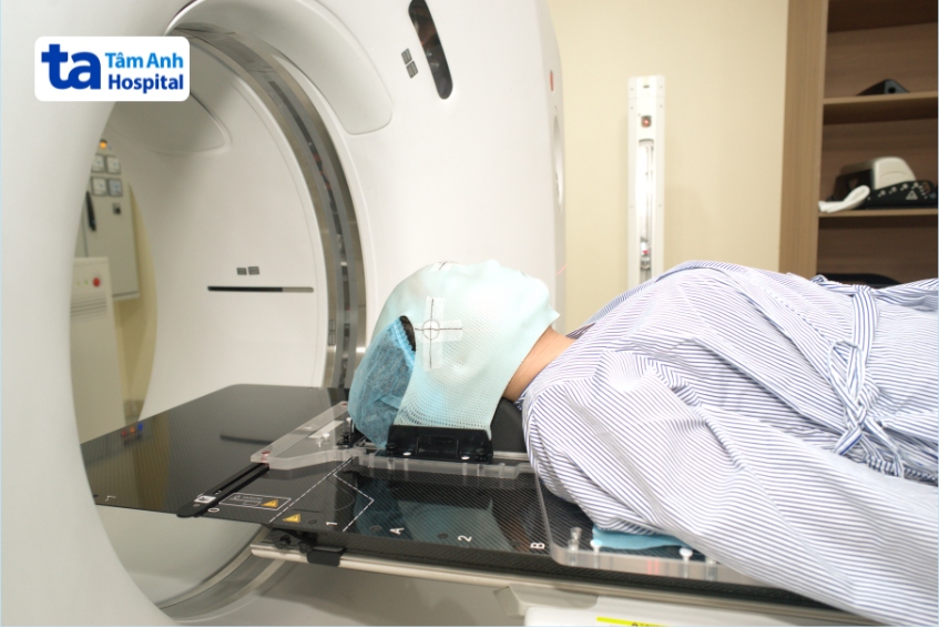 người bệnh mang mặt nạ xạ trị và được chụp ct mô phỏng tại khoa xạ trị, bệnh viện đa khoa tâm anh tp.hcm