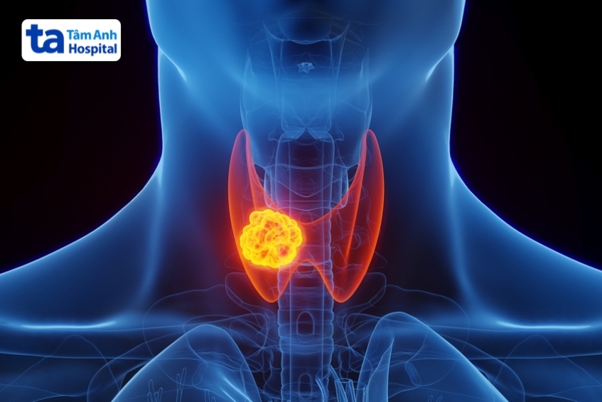 người bị ung thư tuyến giáp có thể ăn gạo lứt