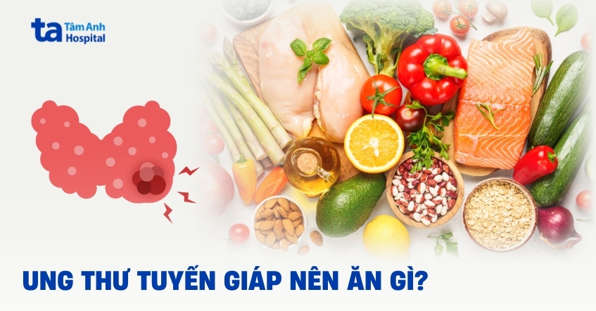 Người bị ung thư tuyến giáp nên ăn gì và kiêng gì?