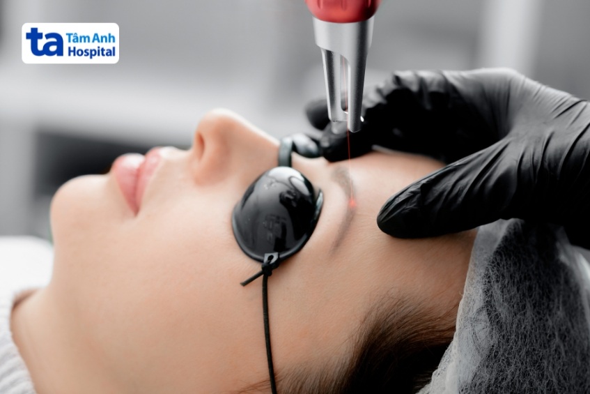 nguyên nhân khiến xóa laser lông mày bị viêm đỏ