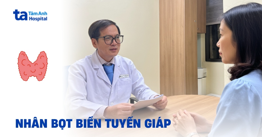 Bạn biết gì về nhân bọt biển tuyến giáp?