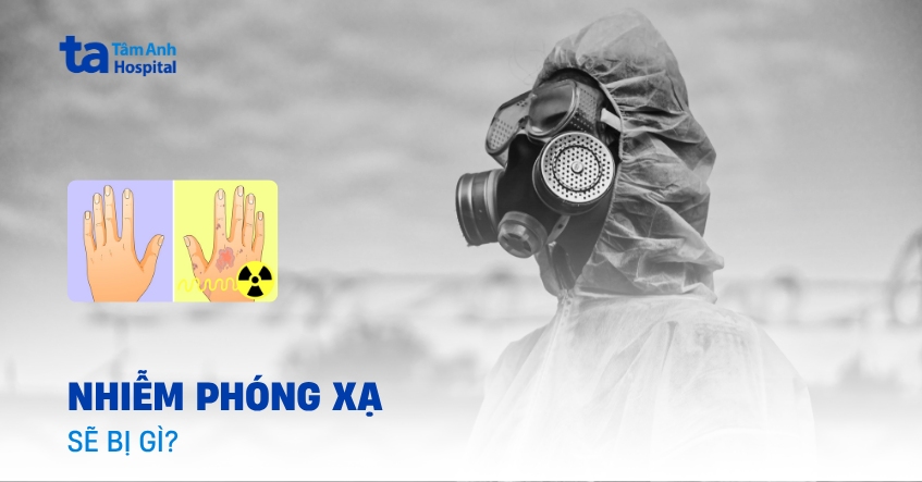Nhiễm phóng xạ sẽ bị gì? Dấu hiệu và cách phòng tránh