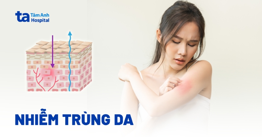 Nhiễm trùng da: Nhận biết những dạng thường hay mắc phải