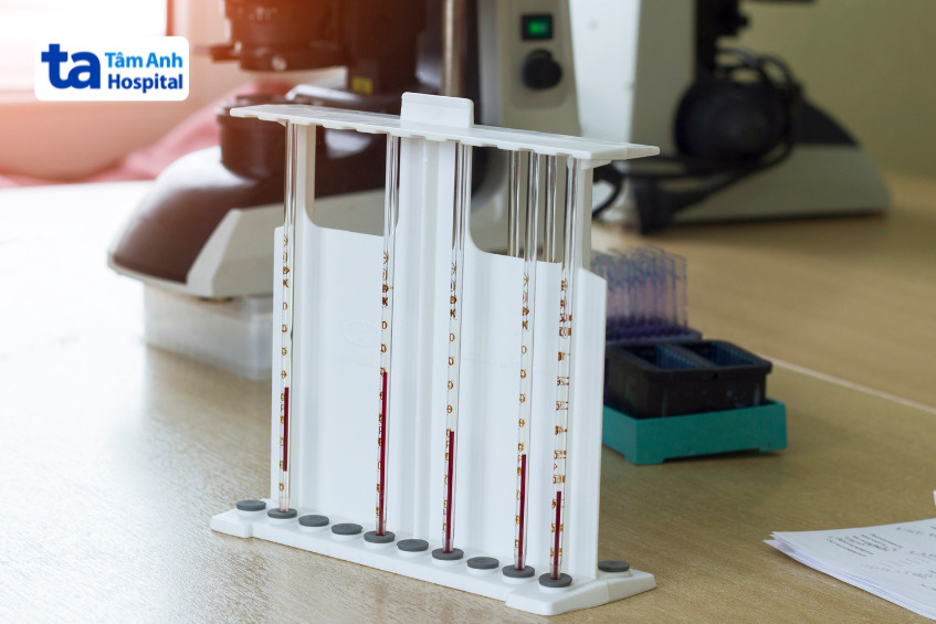 ống đo tốc độ máu lắng