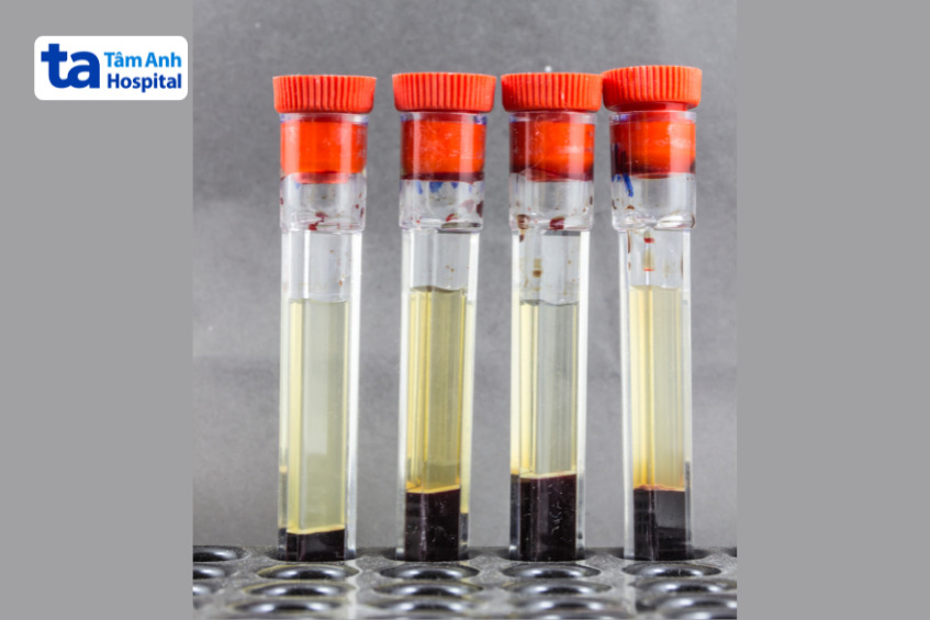 ống nghiệm chứa hồng cầu lắng