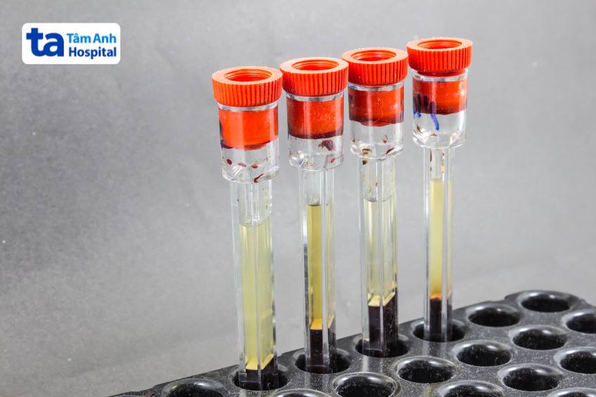 ống nghiệm chứa mẫu máu đang đo tốc độ lắng