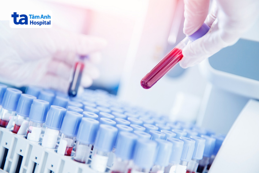 ống nghiệm chứa mẫu máu tại phòng xét nghiệm