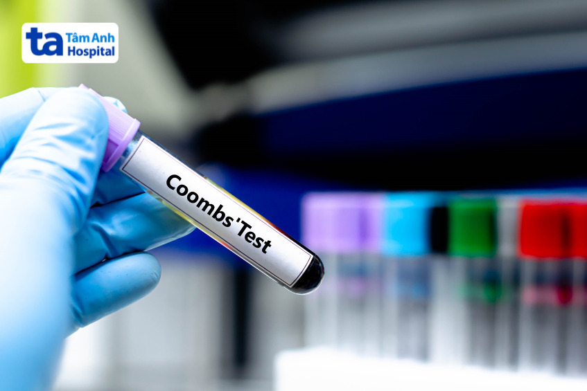 Ống nghiệm chứa mẫu máu thực hiện xét nghiệm coombs