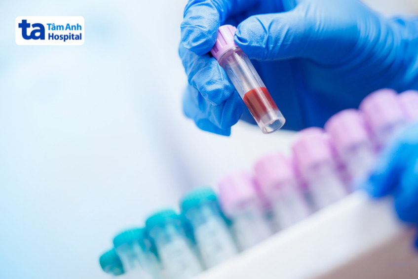 ống nghiệm chứa mẫu máu xét nghiệm hồng cầu lưới