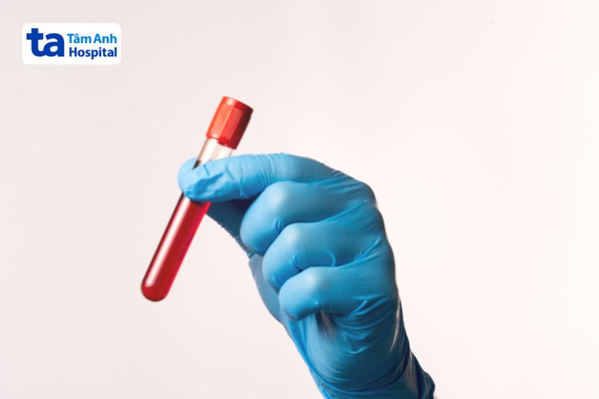 ống nghiệm chứa mẫu máu xét nghiệm