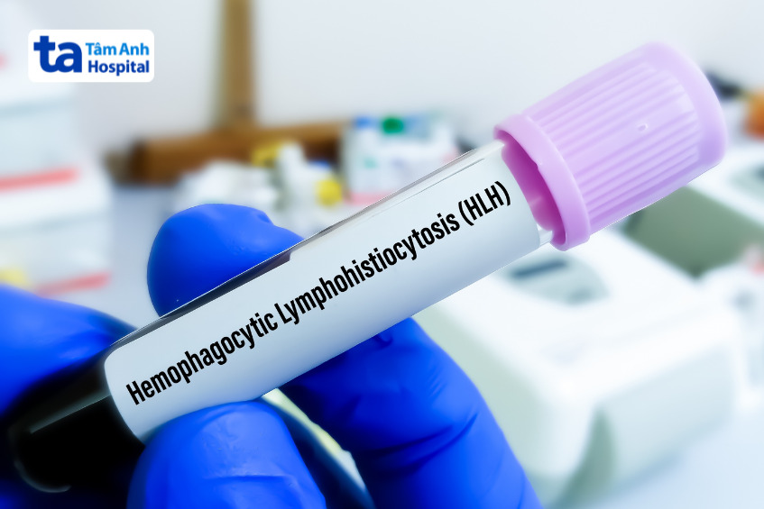 ống nghiệm dán nhãn hemophagocytic lymphohistiocytosis (hlh)