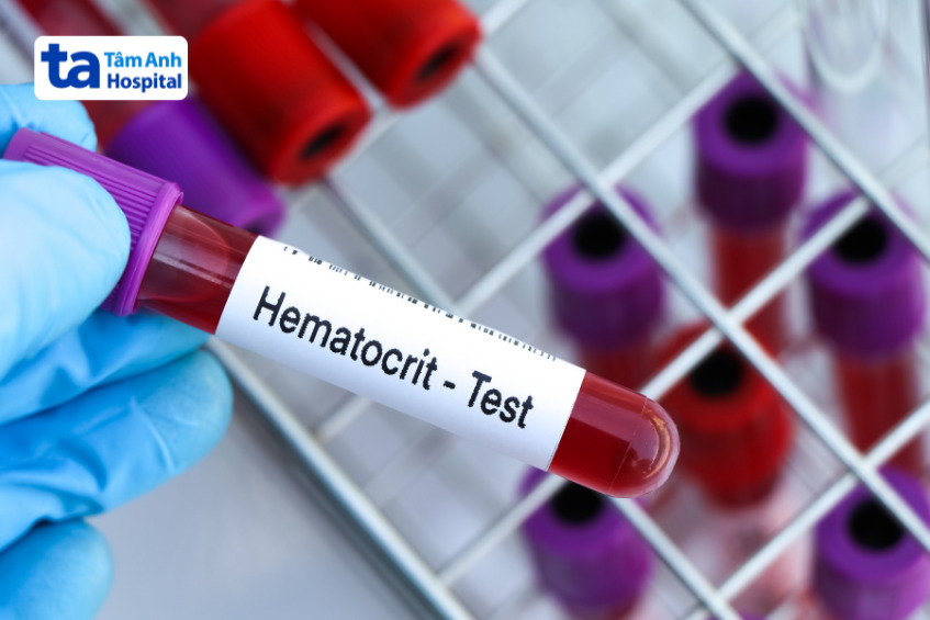 ống nghiệm dán nhãn hematocrit