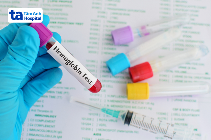 ống nghiệm chứa huyết sắc tố