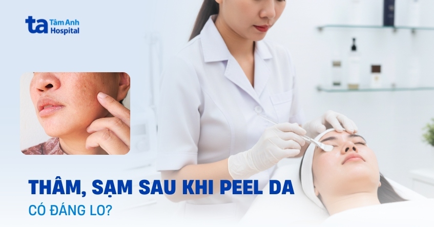 Sau khi peel da bị thâm, sạm có phải dấu hiệu bất thường?