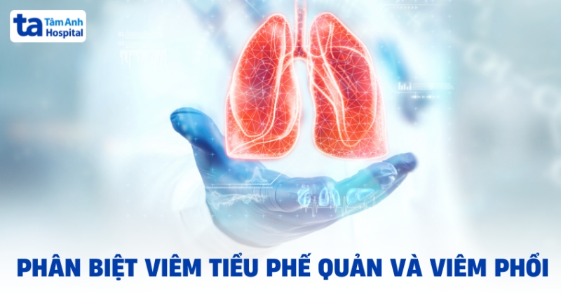 Cách phân biệt viêm tiểu phế quản và viêm phổi chi tiết A-Z