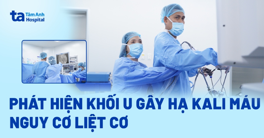 Phát hiện khối u gây hạ kali máu, nguy cơ liệt cơ
