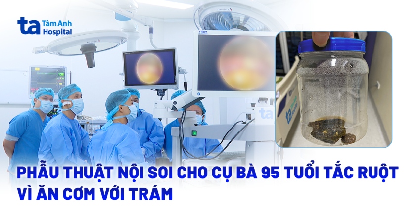 Phẫu thuật nội soi cho cụ bà 95 tuổi tắc ruột vì ăn cơm với trám