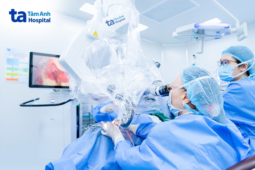 phẫu thuật qua kính vi phẫu