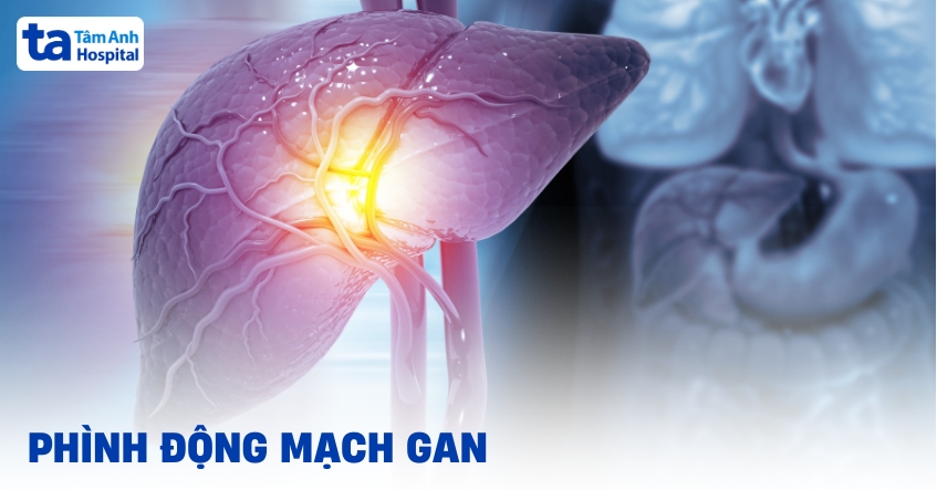 Làm sao phình động mạch gan để xác định nguyên do?