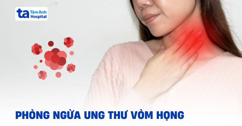 Cách phòng ngừa ung thư vòm họng hiệu quả