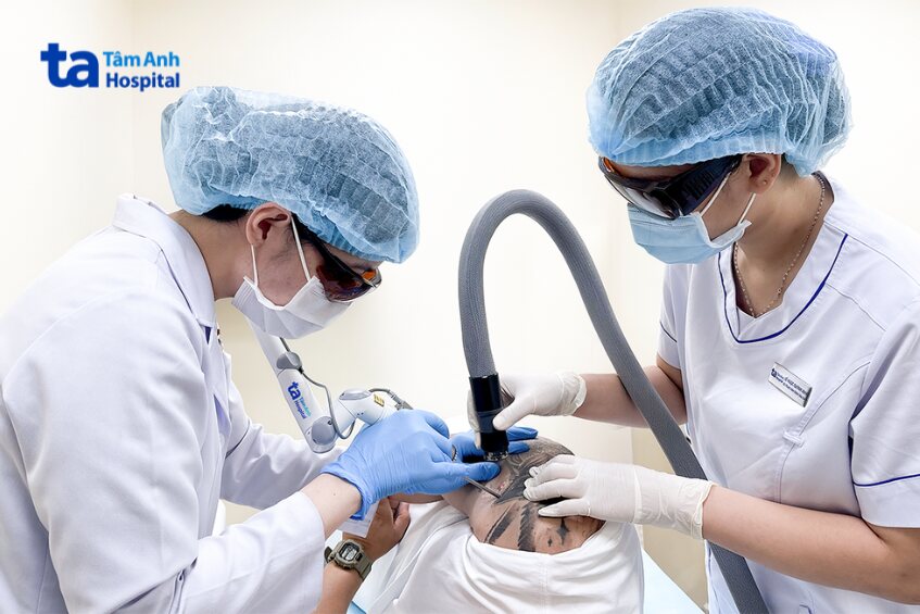 quy trình xóa laser mực đỏ tại tâm anh