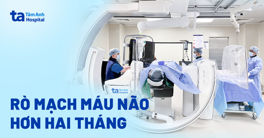 Rò mạch máu não hơn hai tháng
