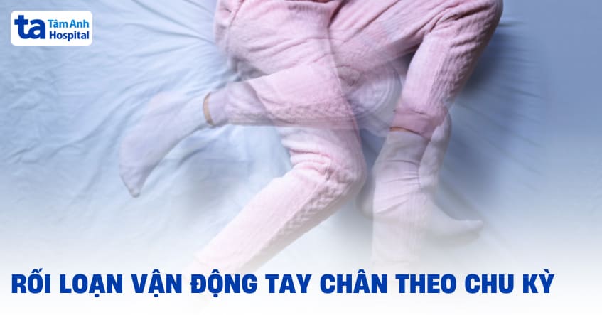 Rối loạn vận động tay chân theo chu kỳ (PLMD)