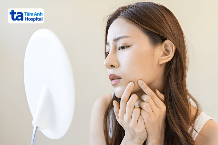 rủi ro khi nặn mụn sau khi tiêm filler