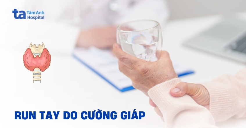 Run tay do cường giáp có xảy ra với tất cả mọi người không?