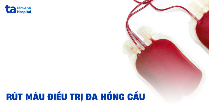 Chỉ định rút máu điều trị đa hồng cầu áp dụng khi nào?