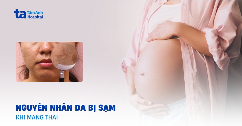 Nám, sạm da khi mang thai khi nào sẽ có thể biến mất?