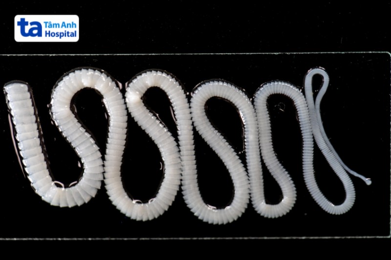 sán cá trưởng thành