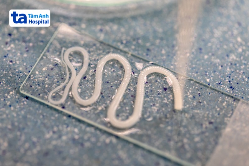 hình ảnh sán dải cá thường dài