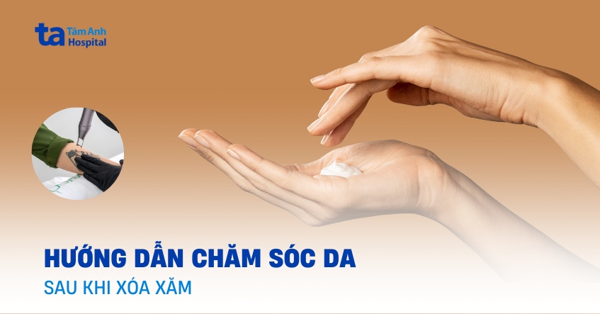 Sau khi xóa xăm bôi thuốc gì? Hướng dẫn chăm sóc da mau lành