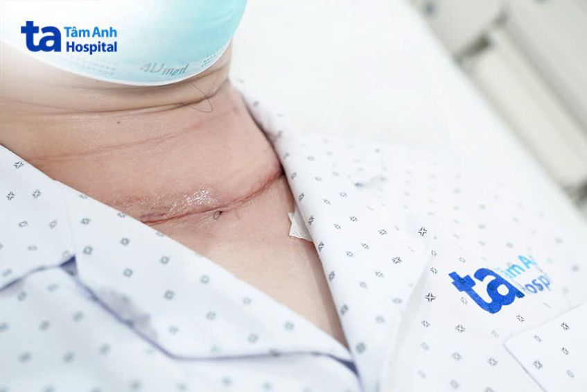 sau mổ vết thương khô ráo và sức khoẻ ổn định