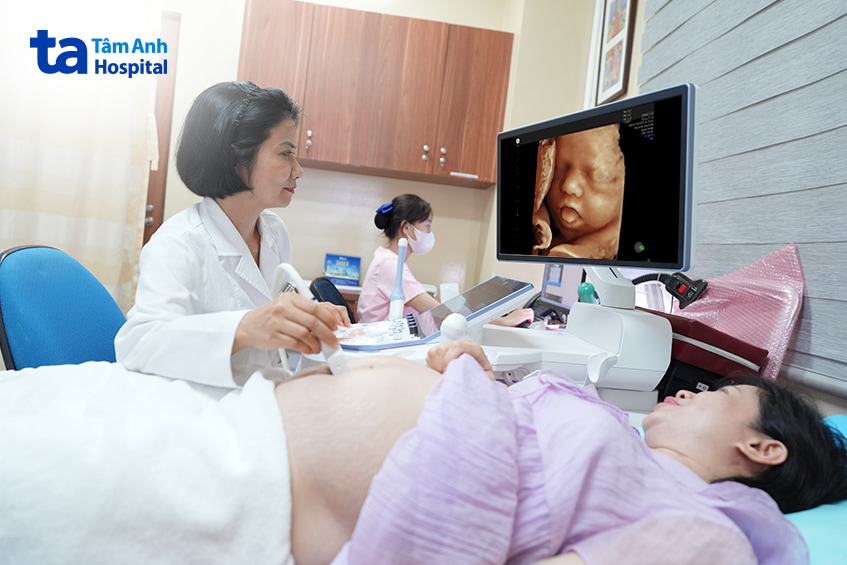 Bác sĩ siêu âm cho mẹ bầu, hiển thị hình ảnh thai nhi rõ nét bằng công nghệ 4D tại Bệnh viện Tâm Anh