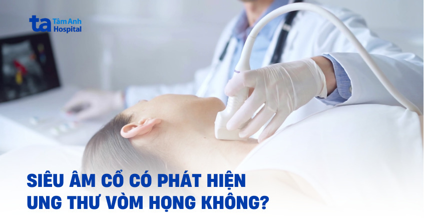 Siêu âm cổ có phát hiện ung thư vòm họng không?