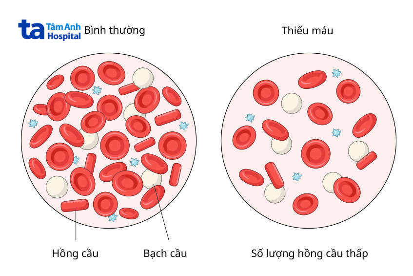 sự khác biệt giữa số lượng hồng cầu